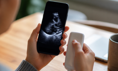 Ultrassom no Celular: Apps e Como Usar