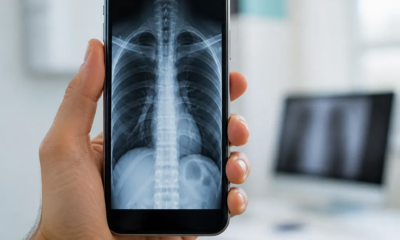 Raio X Digital: Visualize Imagens Médicas no Seu Celular
