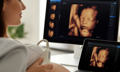 Como Usar IA para Ver Seu Bebê na Gravidez em Detalhes